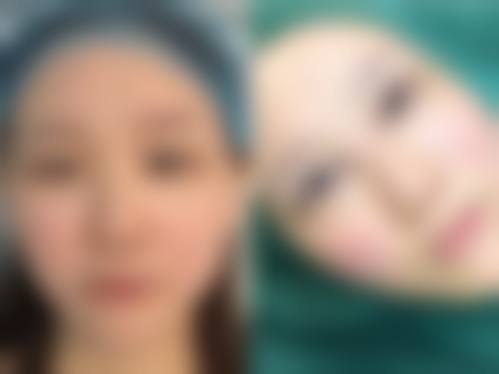 七、常熟市第二人民医院整形美容科价格表:(仅供参考)