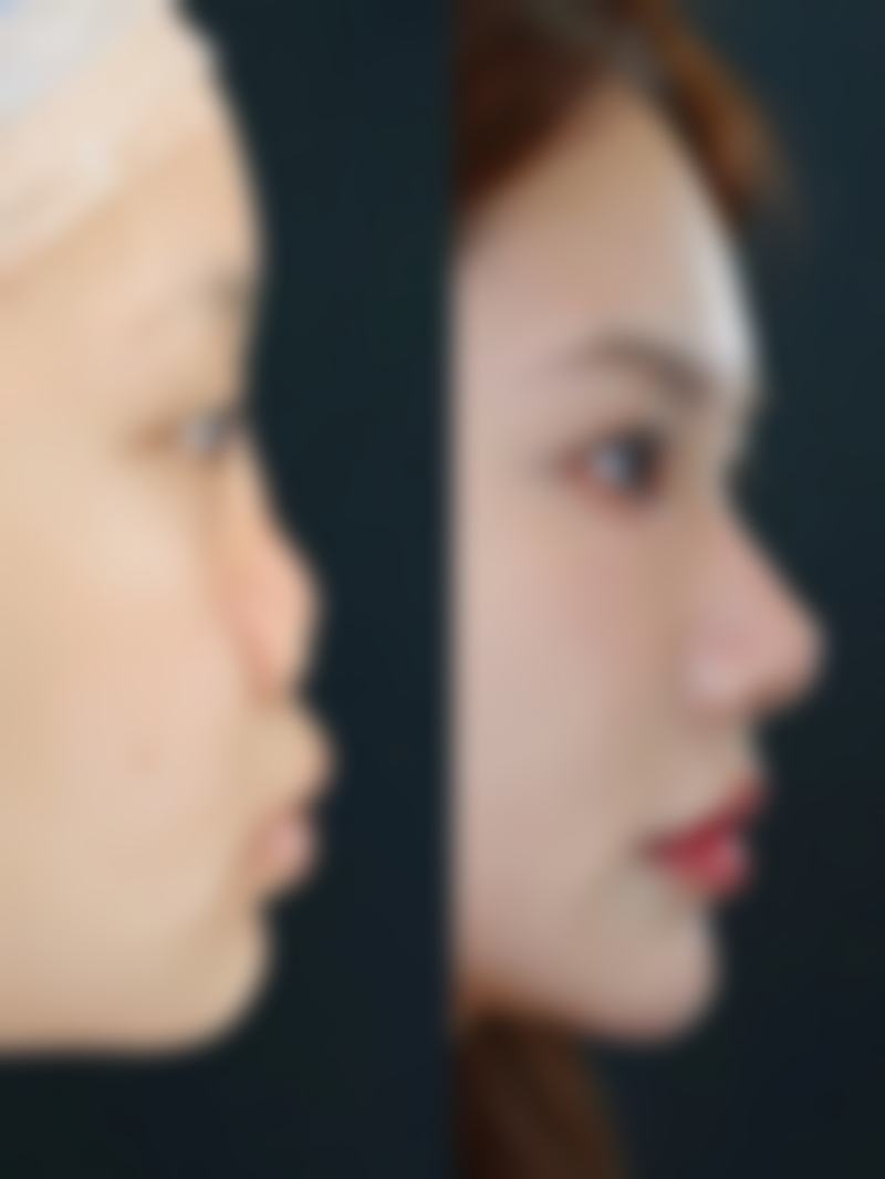 八、成都高新悦妍悦蜜整形医院真实的顾客评价如下: