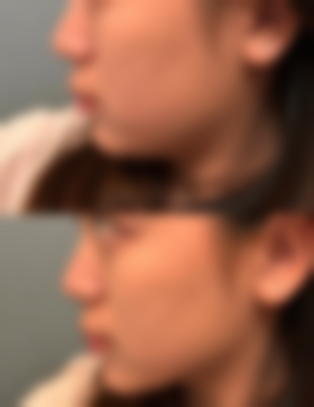 鲍海萍医生怎么样可靠吗?