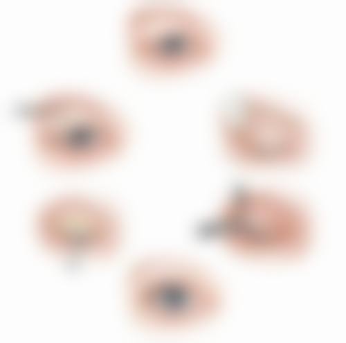 手术治疗出击:解决顽固疤痕问题