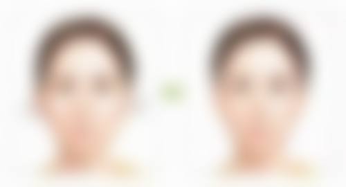 物理治疗助力:改善疤痕颜色质地