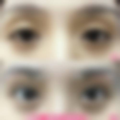 七、黎美整形美容门诊部真实的顾客评价如下: