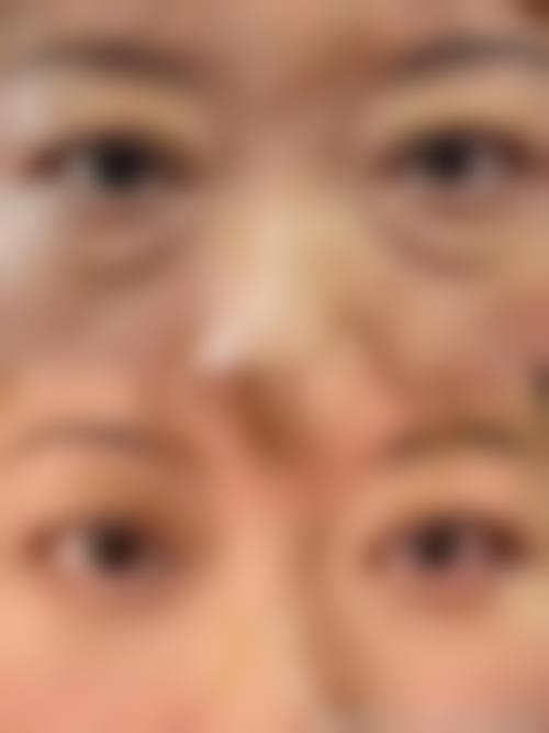 五、厦门湖里瑞妍整形医院实例