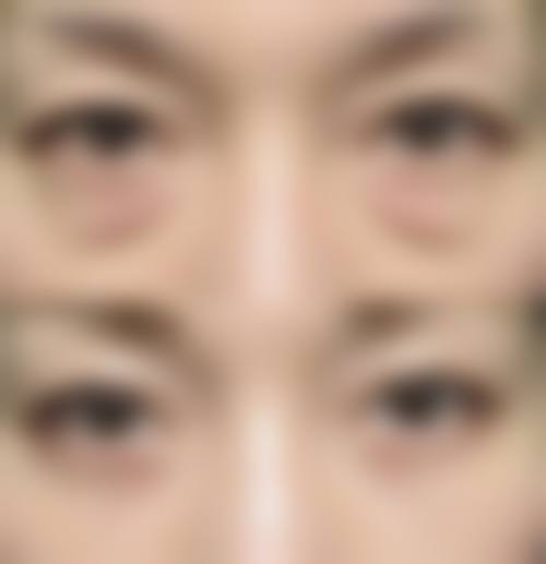 八、厦门湖里瑞妍整形医院真实的顾客评价如下: