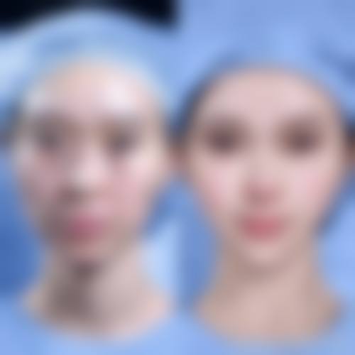 五、长沙无龄(雅瑷)医疗美容医院实例