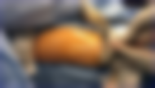 四、黎美整形美容门诊部实例