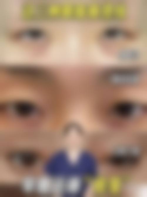 五、广州玺丽医疗美容部实例