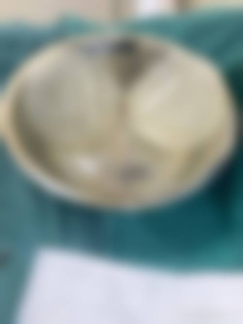 二、广州玺丽医疗美容部正规吗？来看看医院资质：