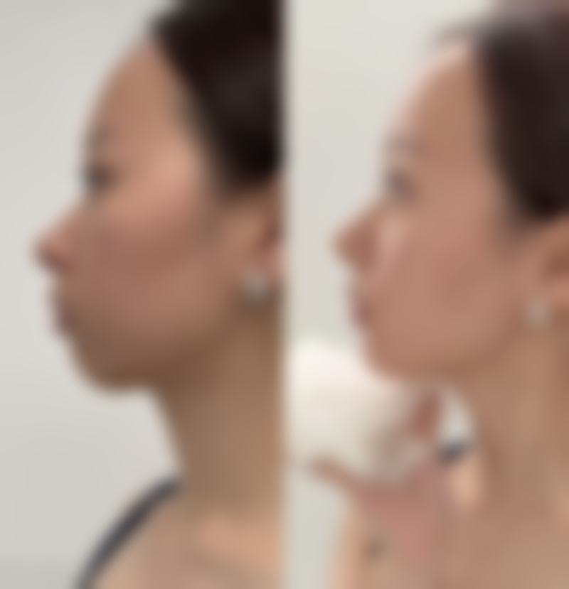 蒸汽眼罩的其他核心作用,助力眼部健康