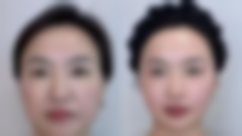 七、杭州新漾医疗美容诊所价格表：（仅供参考）