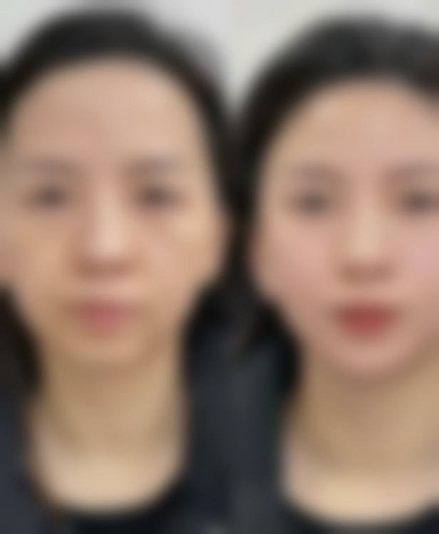 黄喨谊医生怎么样可靠吗?