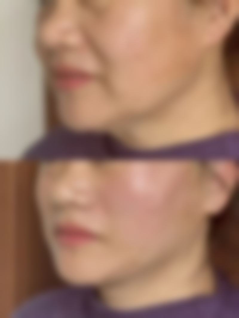 杨欢腊医生在哪家医院