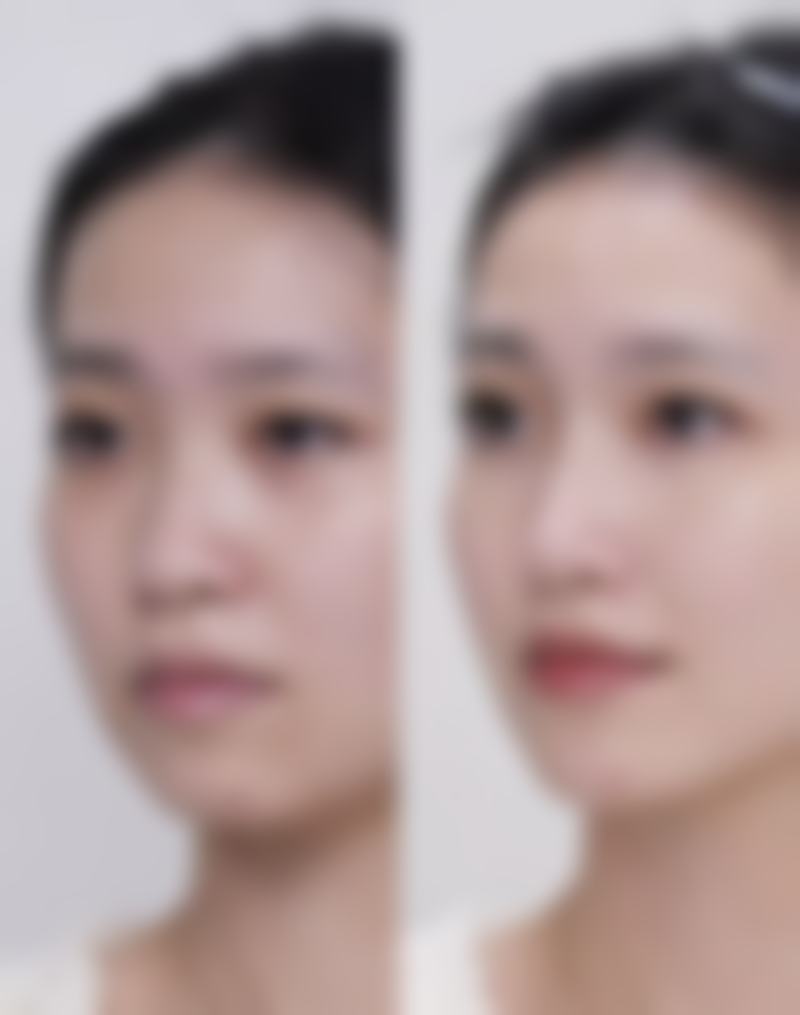 八、广州玺丽医疗美容部真实的顾客评价如下：