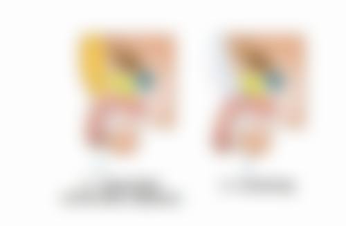 拉双眼皮修复时间大揭秘！不同医生和资料的观点