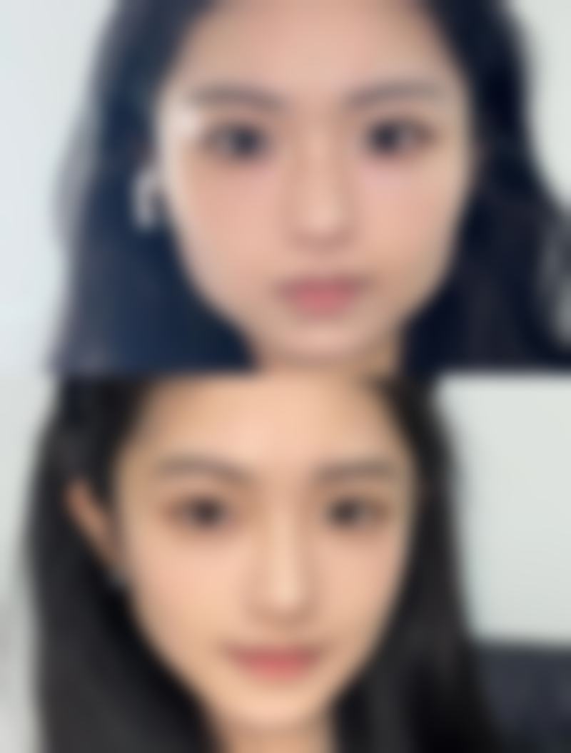 杨小刚医生项目价格表参考