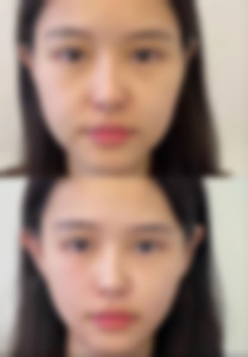 杨小刚医生在哪家医院