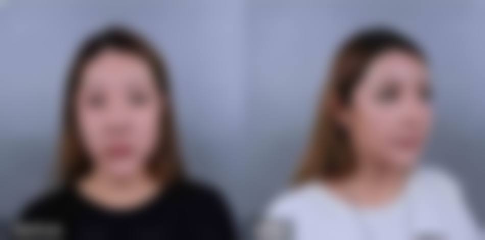 姚志彬医生实例