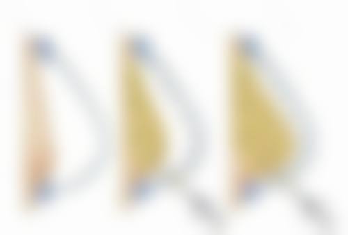 双眼皮究竟算不算整容？就医与护理要点