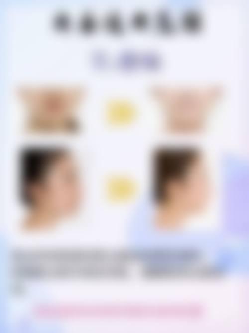 自体脂肪隆胸短板之脂肪成活率问题