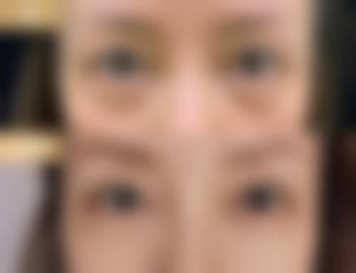 八、北京丽莱伊整形医院真实的顾客评价如下：