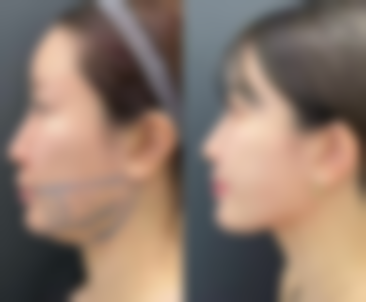 还在为疤痕红印苦恼？日常护理不能少