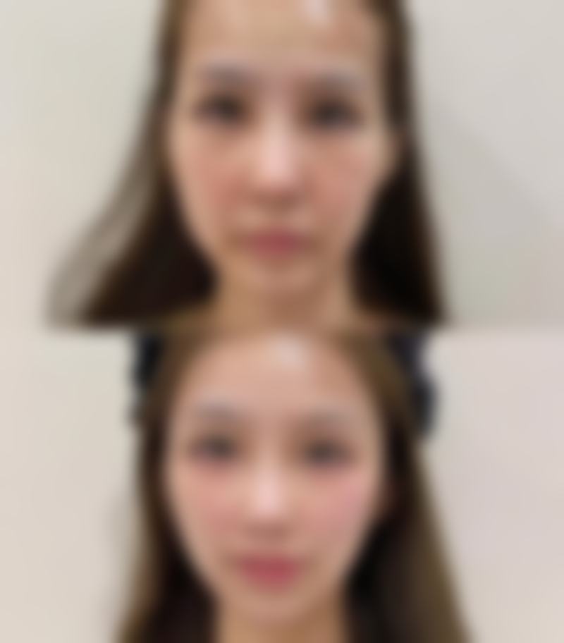 七、韩国will医院价格表：（仅供参考）