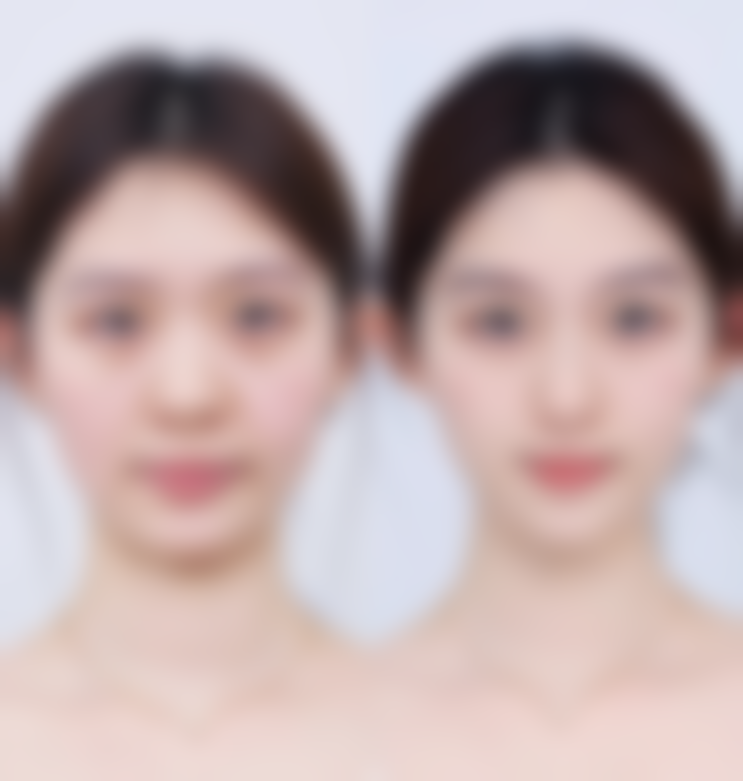 七、洛阳美莱整形医疗美容医院价格表:(仅供参考)