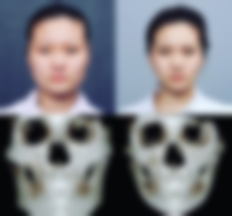 还在为疤痕留下的红印发愁？多种治疗与护理方法助你有效去除红印、修复疤痕 