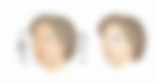 全方面护理助你快速消肿