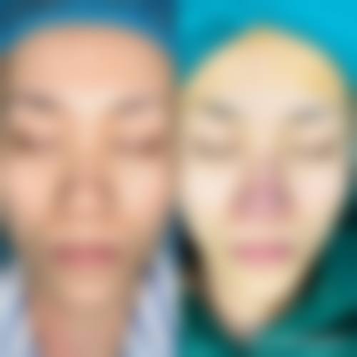 五、三峡大学附属仁和医院(烧伤整形科)实例