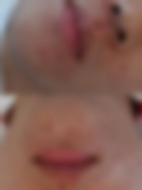 唐善华医生怎么样可靠吗？