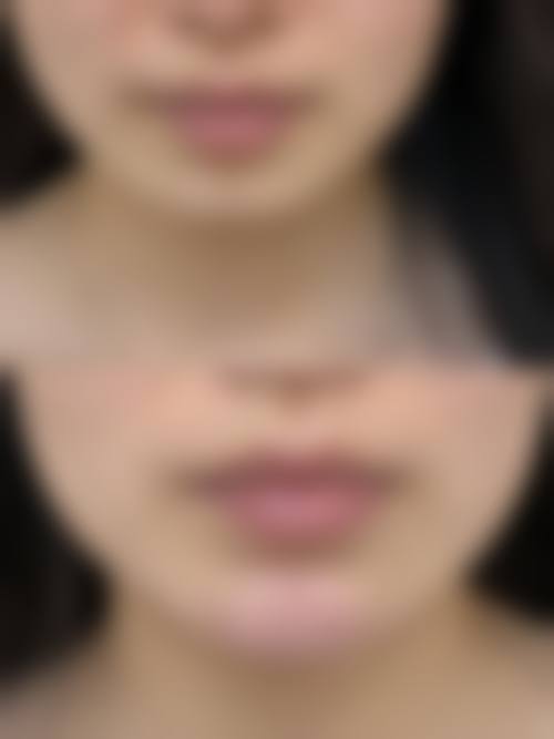 黄喨谊医生怎么预约？