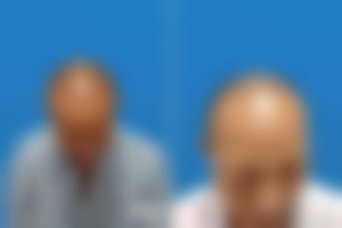 四、太原碧莲盛植发基本信息：