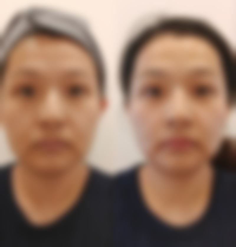 四、深圳美丽方案医疗美容医院开展的主要项目和特色项目：