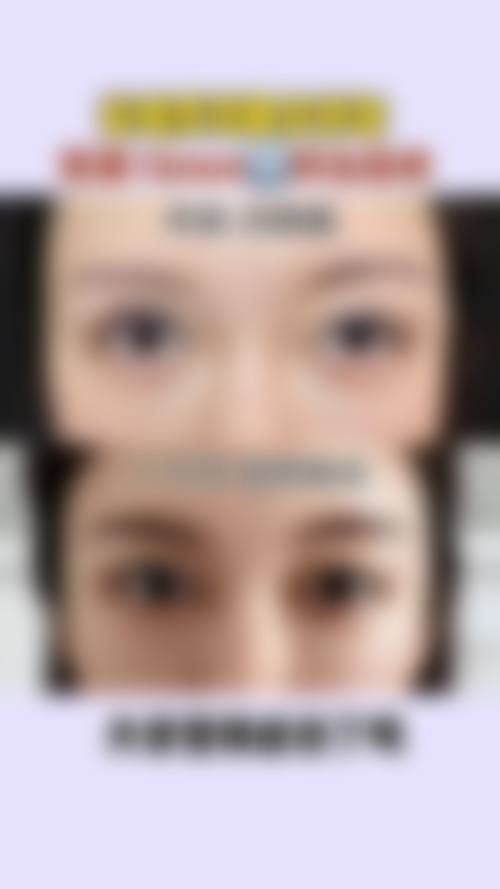 五、济南悦佳人丽格医疗美容门诊部实例