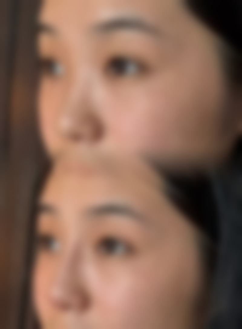 五、杭州阅美医疗美容诊所实例