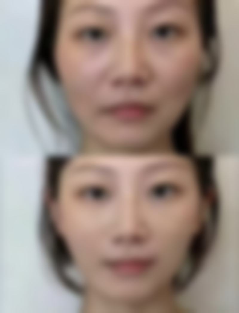 八、忻州美神整形美容门诊部真实的顾客评价如下：