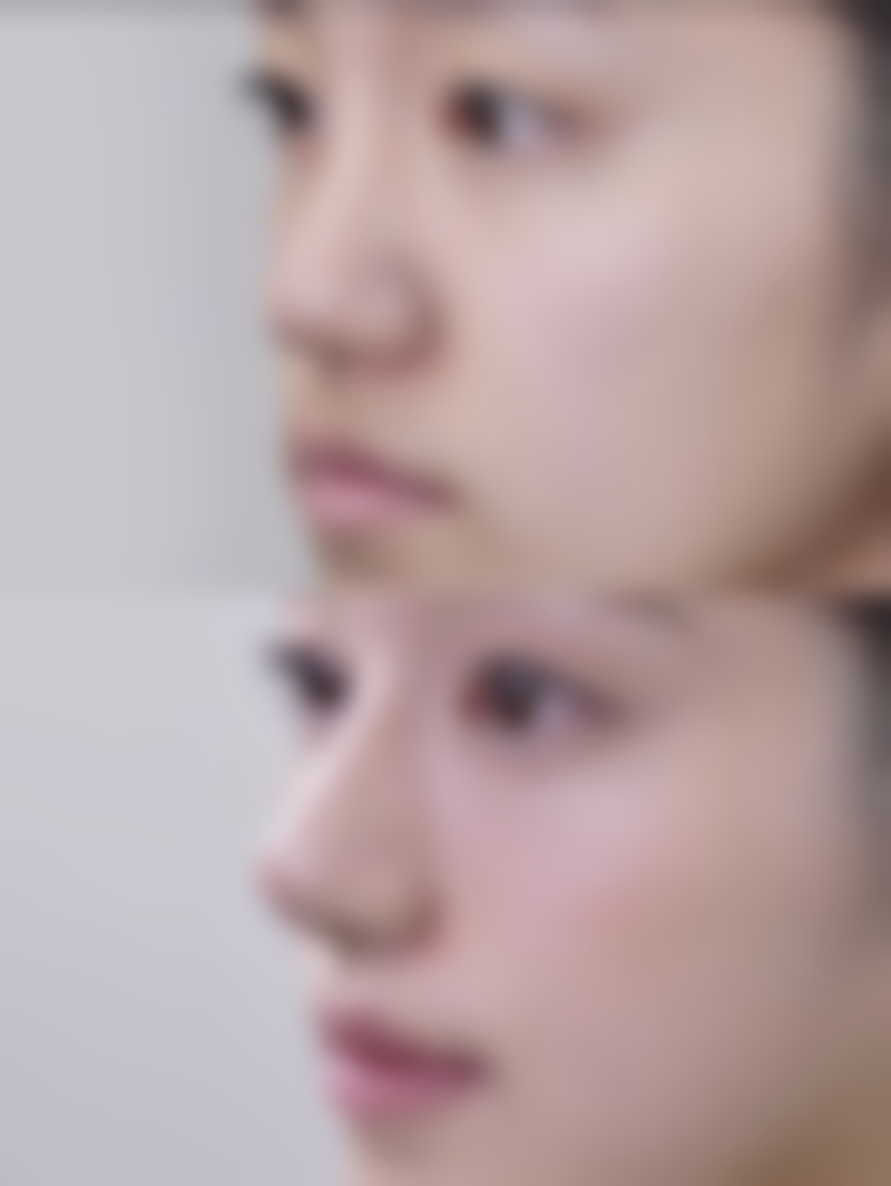 五、湛江玛丽亚整形医院实例