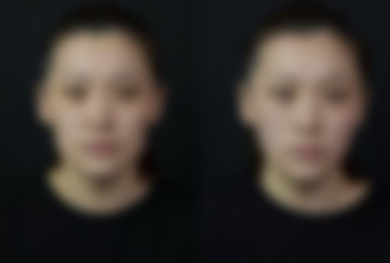 五、成都铂钰医疗美容诊所怎么预约: