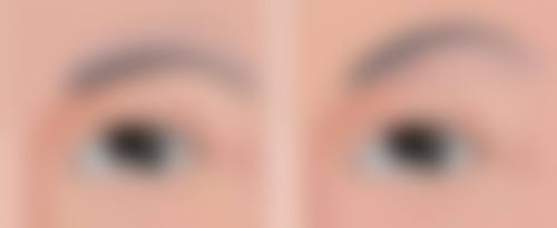 去除黑眼袋用什么？按摩手法的独特魅力