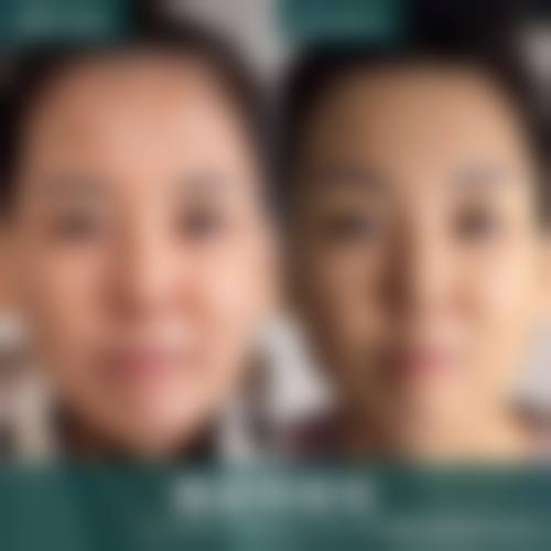 五、张家界瑞美整形门诊部实例