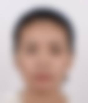 六、无为凯亨整形医院价格表:(仅供参考)