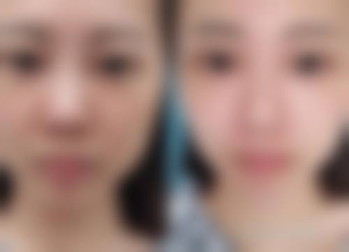 五、无为凯亨整形医院怎么预约: