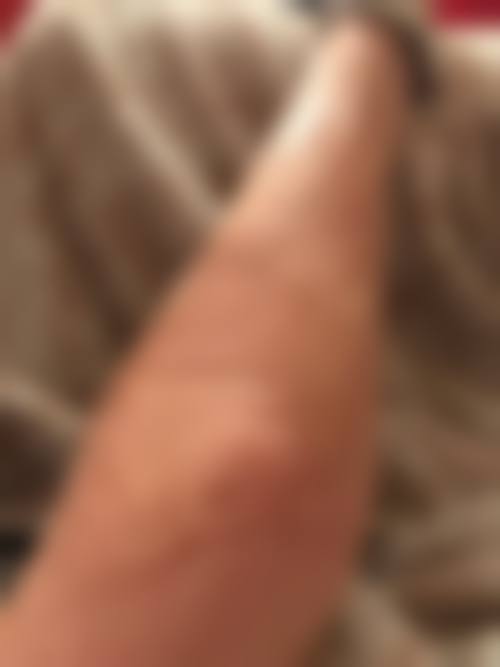 梁志刚医生口碑和评价