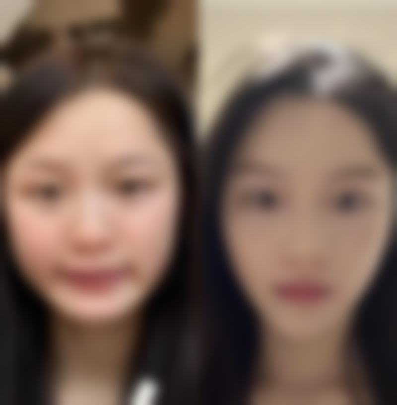 五、济南市第三人民医院整形美容科实例