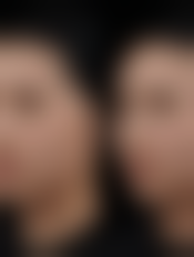 四、无为凯亨整形医院实例