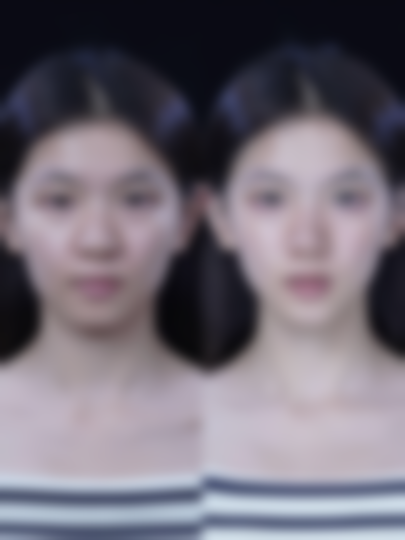 八、济南市第三人民医院整形美容科真实的顾客评价如下: