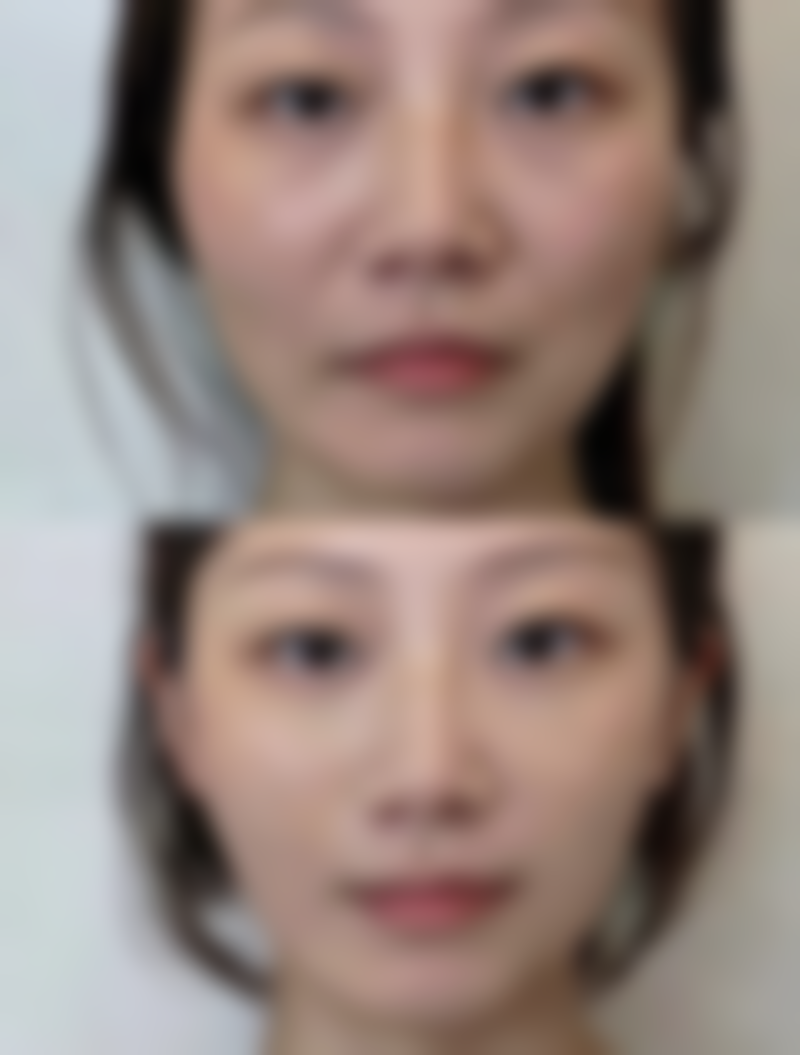 七、济南市第三人民医院整形美容科价格表:(仅供参考)