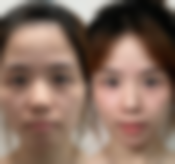 六、张家界瑞美整形门诊部怎么预约：