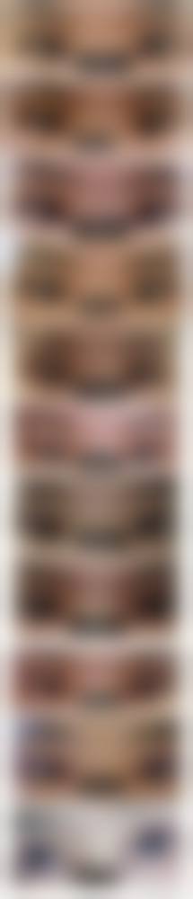 七、义乌市中 心医院烧伤整形外科真实的顾客评价如下: